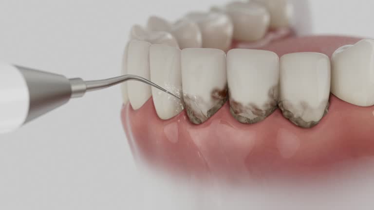 Reliable Dental Implants contractor in Madill, OK by Smile Center Dentistry